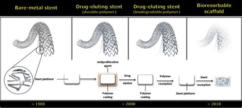 why are bare metal stents fabricated from steel or nitinol|fabrication of stents.